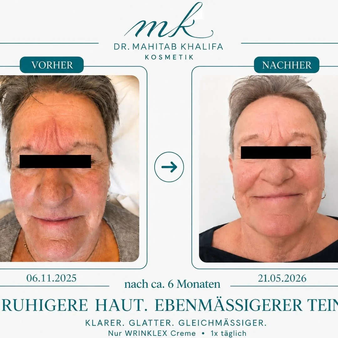 Vorher / Nachher 2